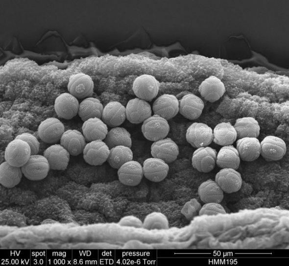 Microscopic view of pollen.