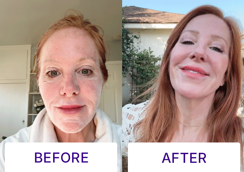BEFORE AFTER