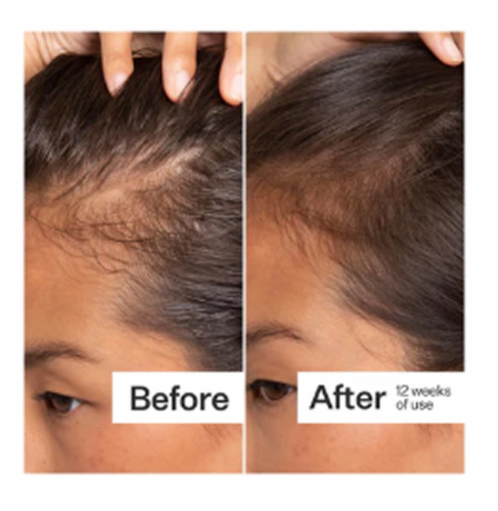 Before and after