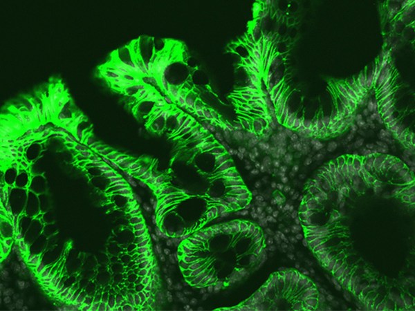An image of mouse colon during chronic colitis displays the effects of inflammation.