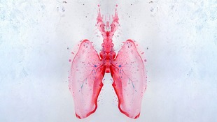 Drug combo shows potential for treating cystic fibrosis