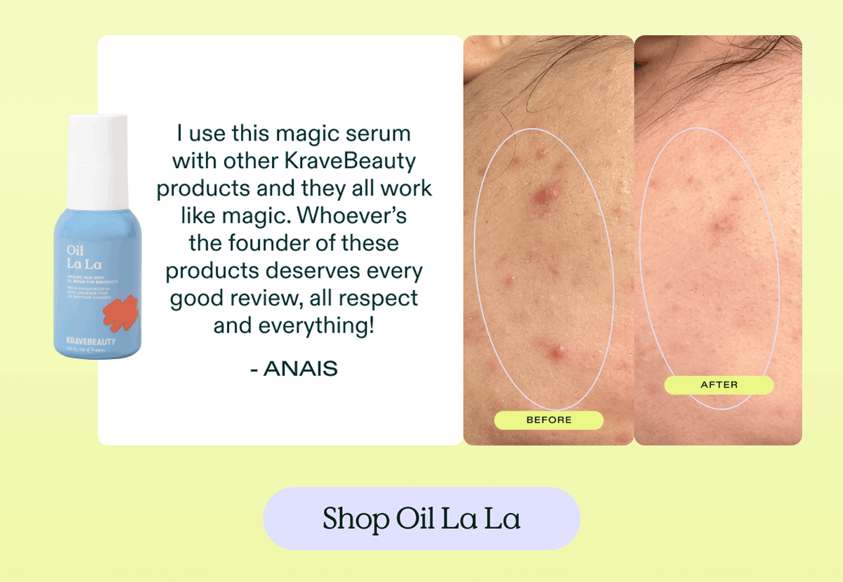 "I use this magic serum with other KraveBeauty products and they all work like magic. Whoever's the founder of these products deserves every good review, all respect and everything!" - Anais. Shop Oil La La serum.