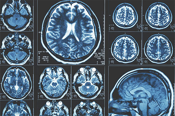 Medical scans of the brain.