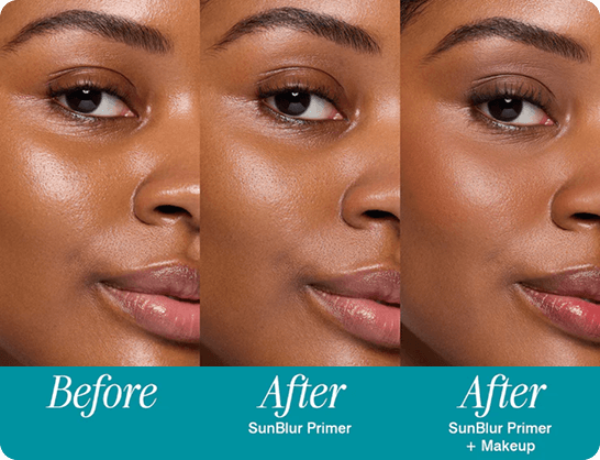 Before | After — SunBlur
