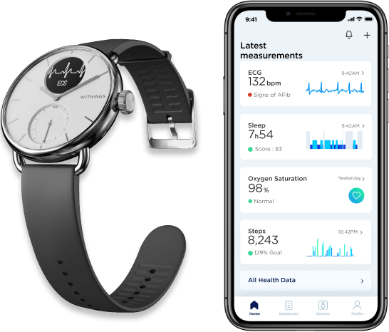 ScanWatch