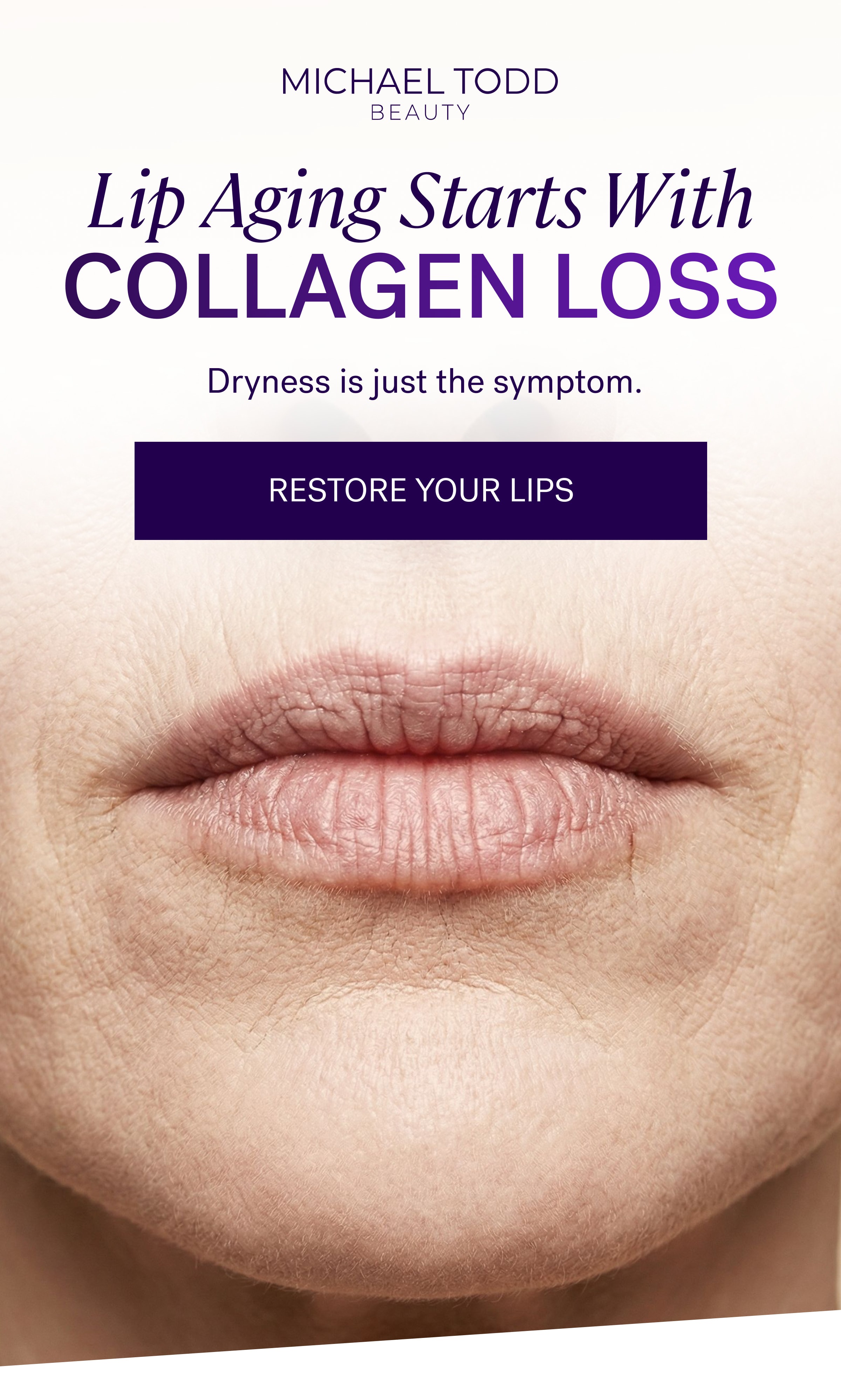Lip Aging Starts With COLLAGEN LOSS  Dryness is just the symptom. Restore Your Lips