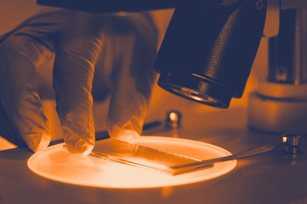 UVA research leads to new lifeline for leukemia patients