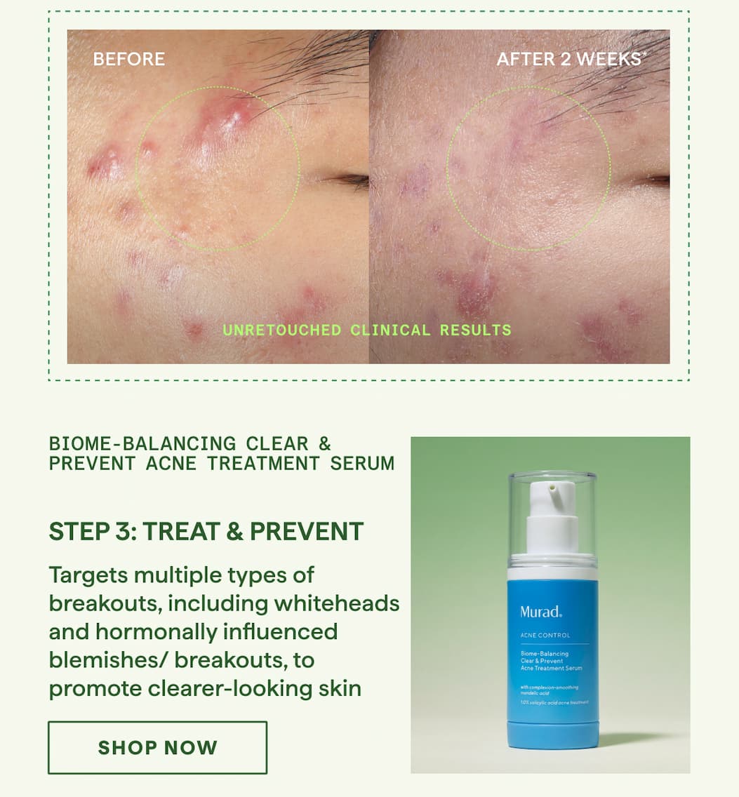 Step 3: Treat & Prevent Biome-Balancing Clear & Prevent Acne Treatment Serum shop now