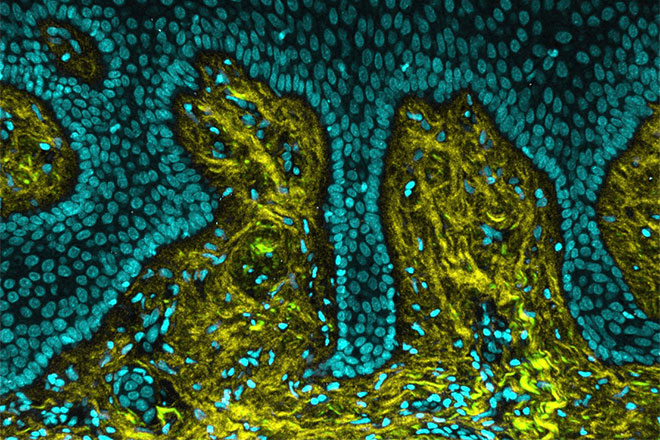 A section of healthy human gum tissue captured using an imaging technique called Second Harmonic Generation microscopy. In this sample, collagen fibers (shown in yellow), which give healthy gums their firm, resilient stiffness, are dense and well-organized—acting as a supportive scaffold for the surrounding cells (shown in teal).