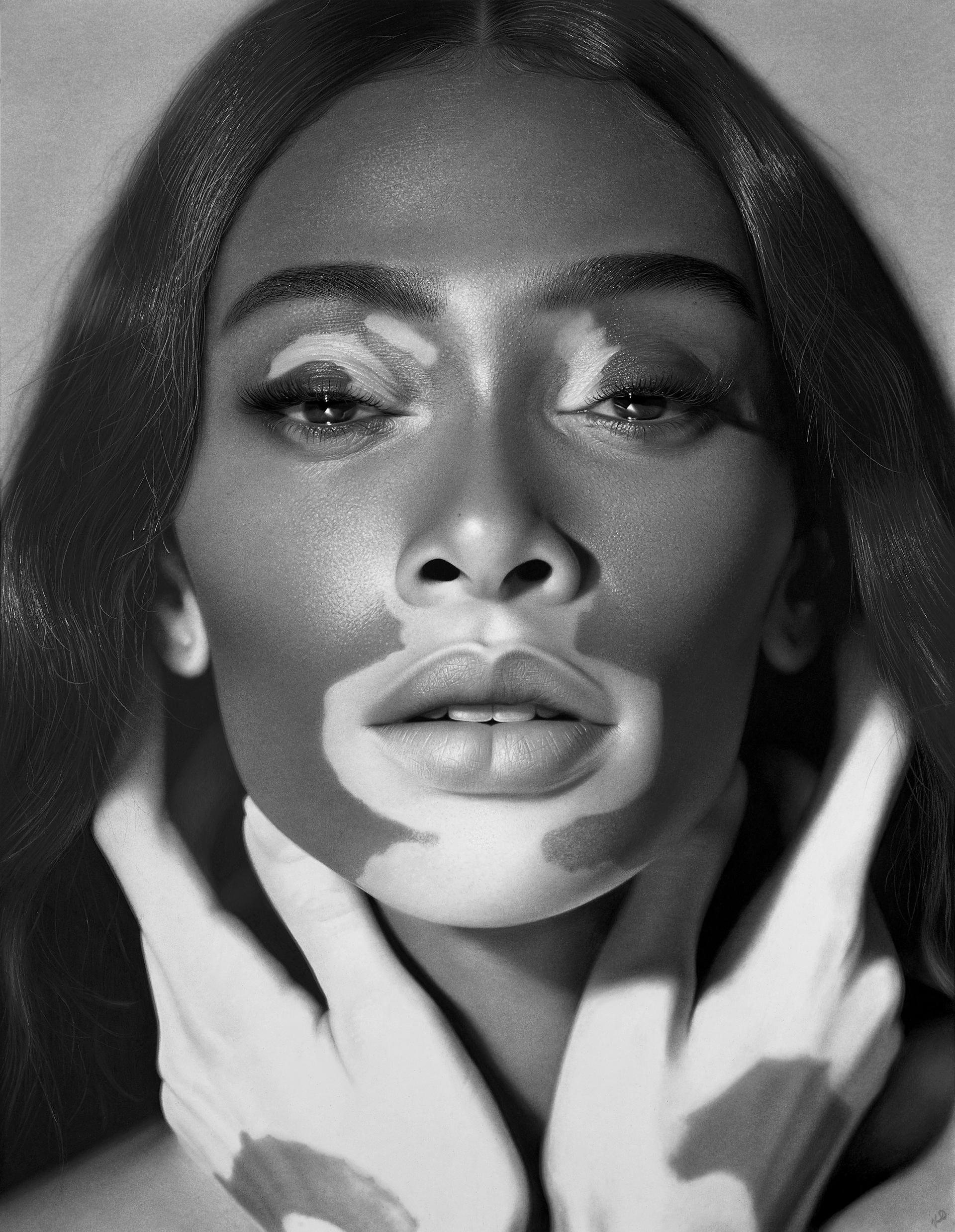 Winnie Harlow