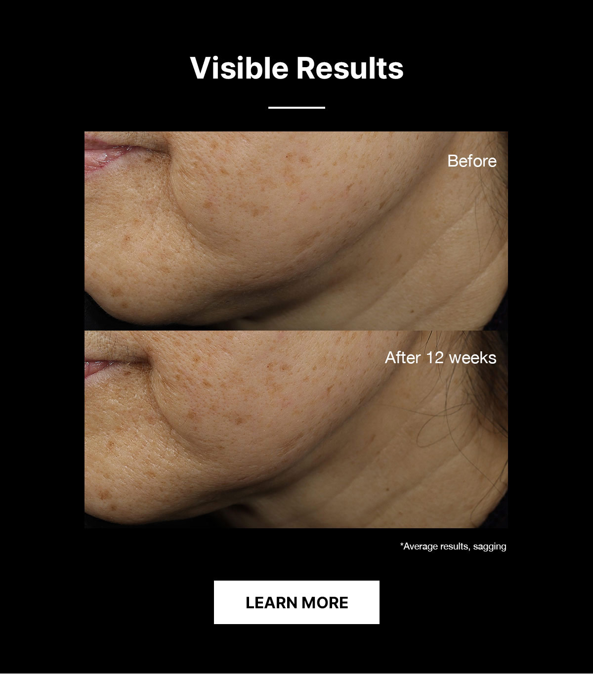 Visible Results