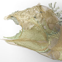 CT scan image of the entire interior skeleton