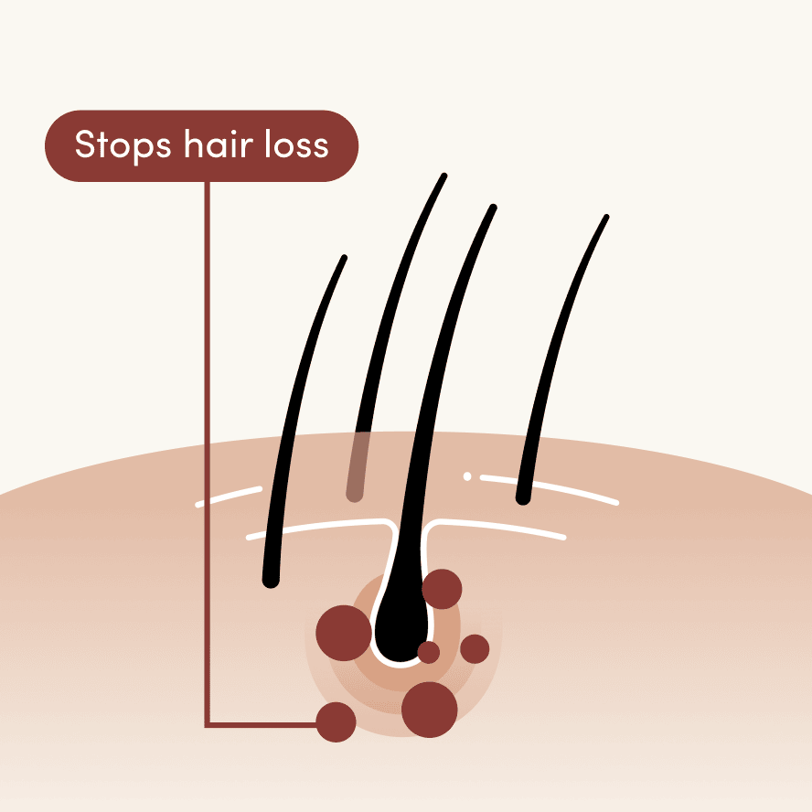 Stops hair loss