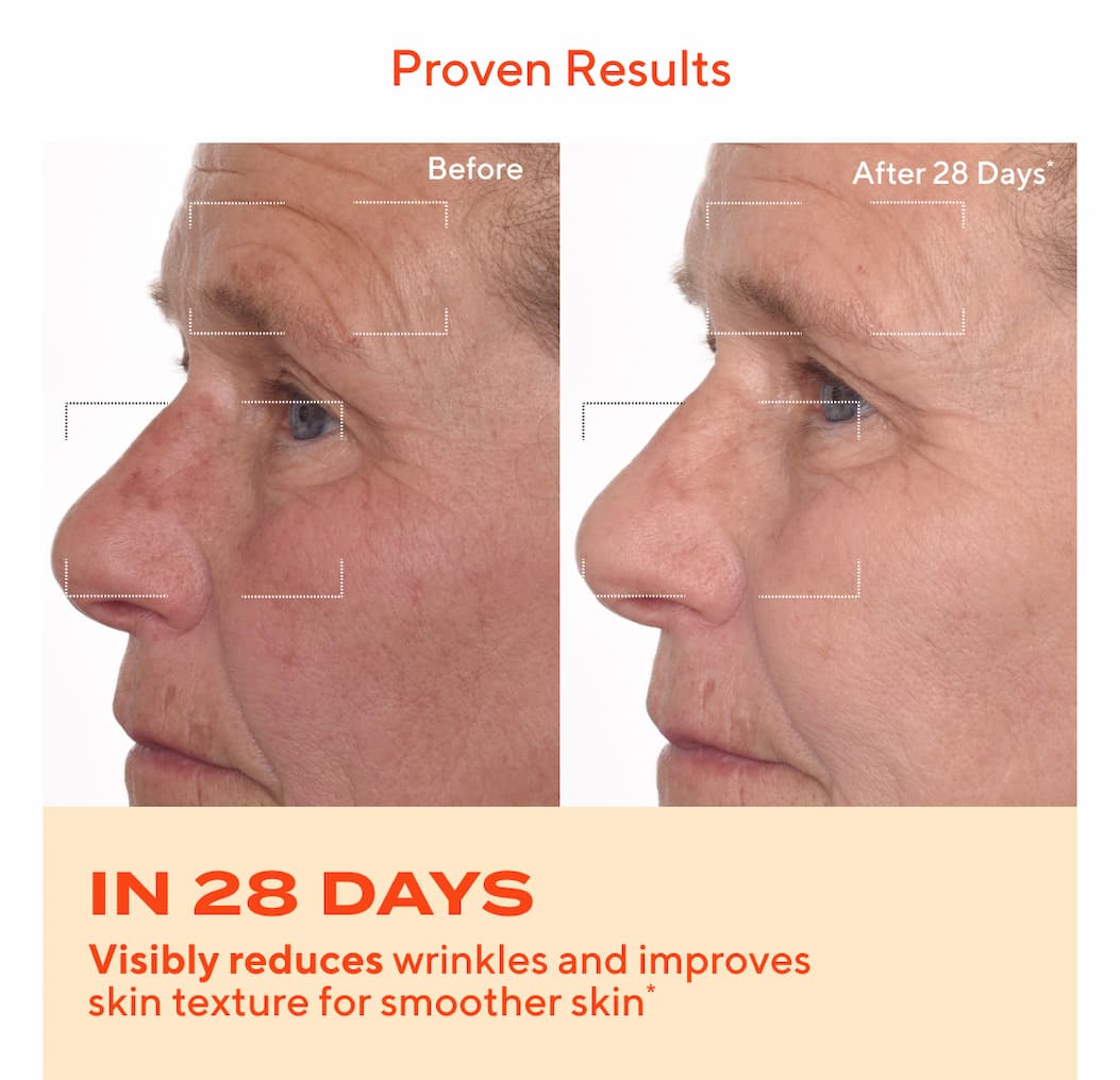 Proven Results 
