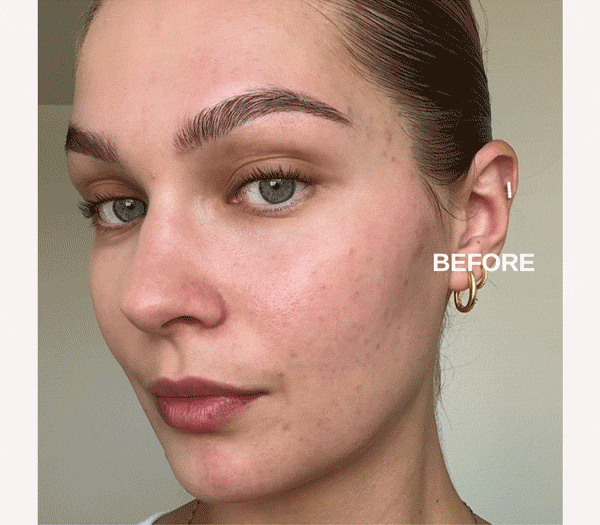 Complexion Perfection 
