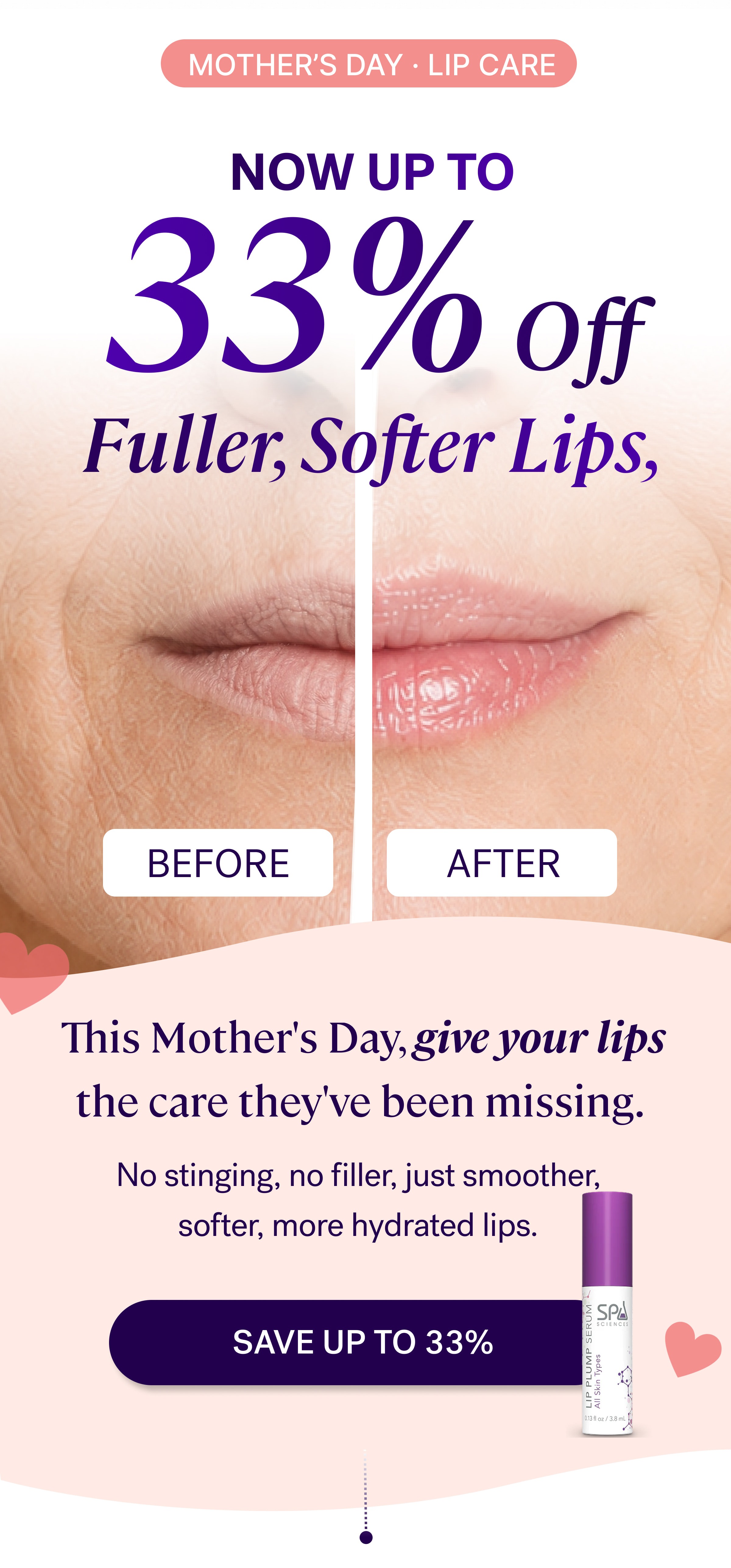 Mother’s day · LIP CARE 33% Off Now Up to Before After This Mother's Day, give your lips the care they've been missing.&nbsp; No stinging, no filler, just smoother, softer, more hydrated lips. SAVE up to 33% 