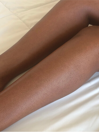 Lower Leg
