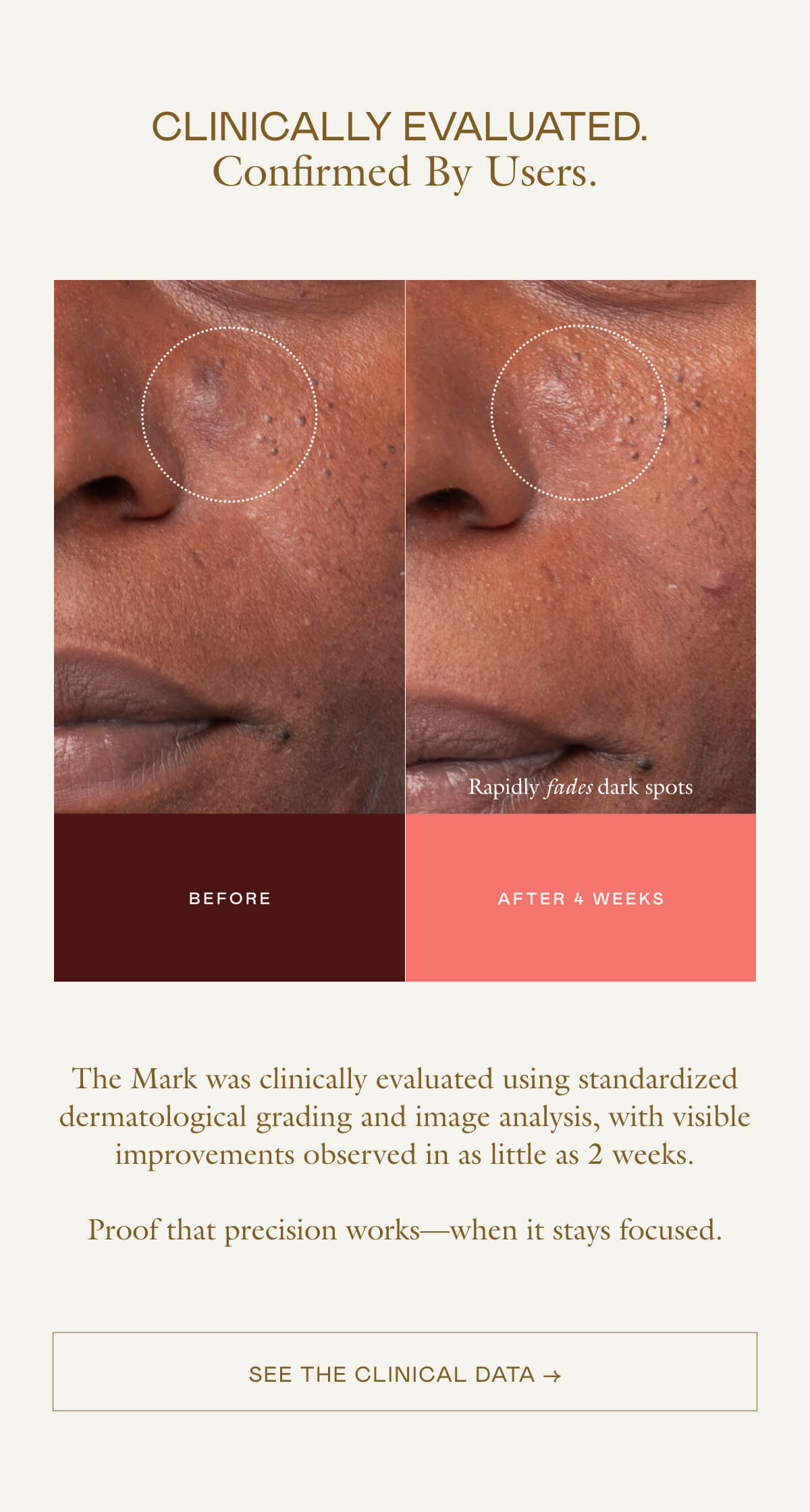 The Mark was clinically evaluated using standardized dermatological grading and image analysis, with visible improvements observed in as little as 2 weeks.  Proof that precision works—when it stays focused.