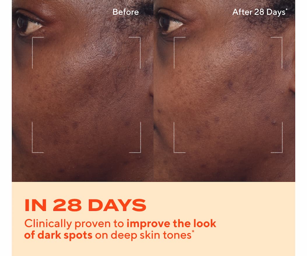 Clinically proven to improve the look of dark spots on deep skin tones 