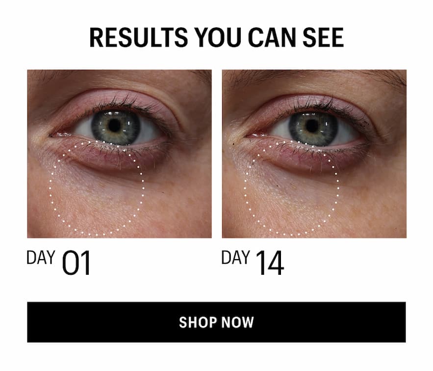 RESULTS YOU CAN SEE - Shop Now