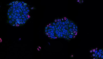 Organoid
