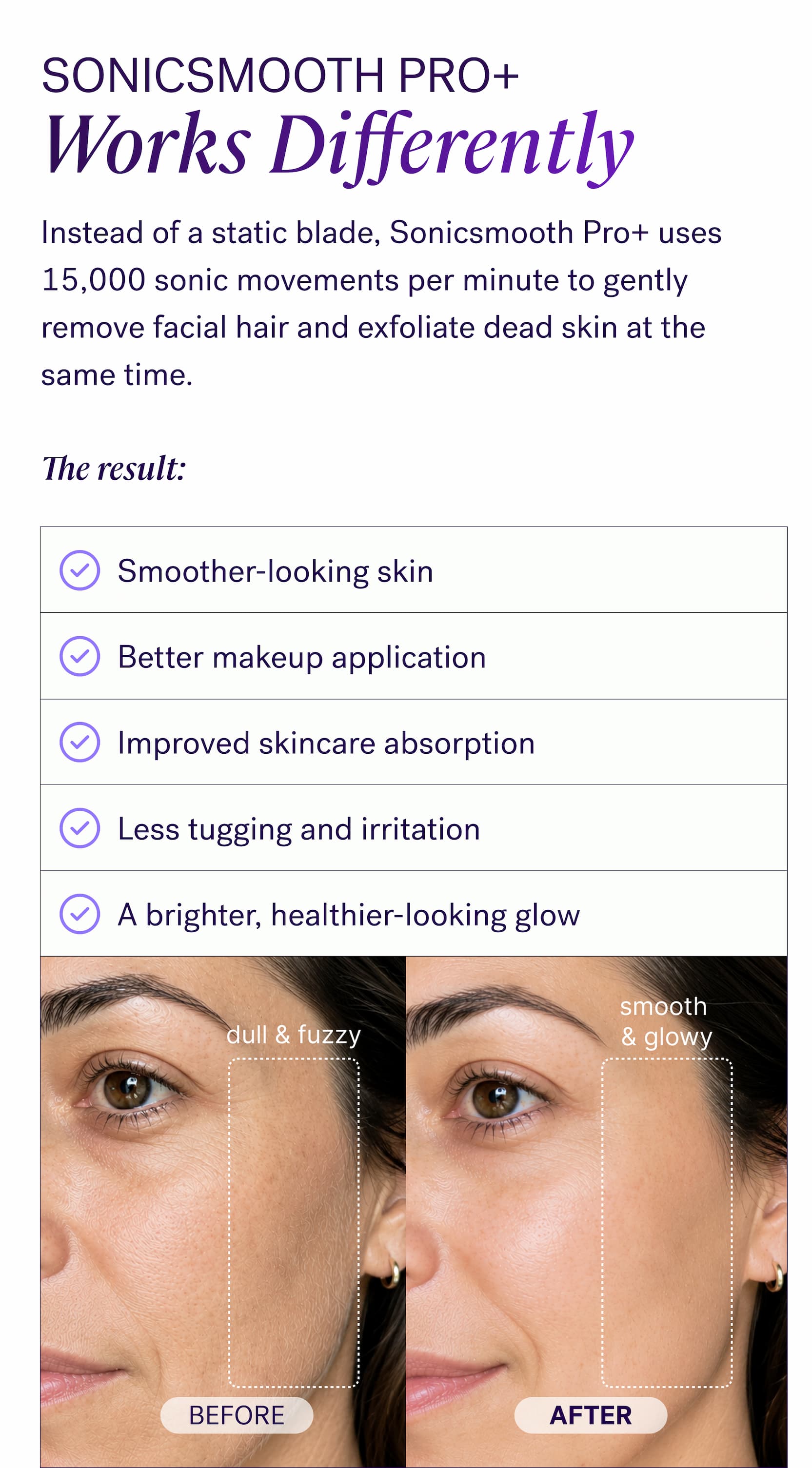 Sonicsmooth Pro+ Works Differently Instead of a static blade, Sonicsmooth Pro+ uses 15,000 sonic movements per minute to gently remove facial hair and exfoliate dead skin at the same time. &nbsp; The result: Smoother-looking skin Better makeup application Improved skincare absorption Less tugging and irritation A brighter, healthier-looking glow BEFORE AFTER