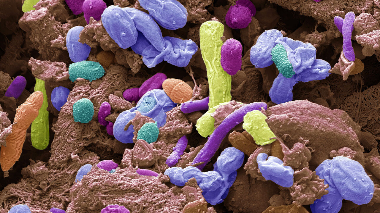 Various bacteria found in a sample from a human intestine.