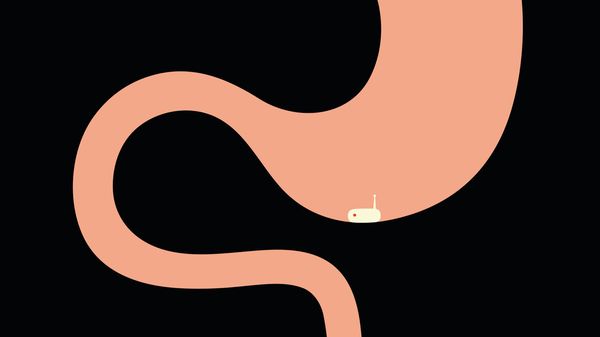Minimal illustration of a stomach and gut with an electronic pill travelling through