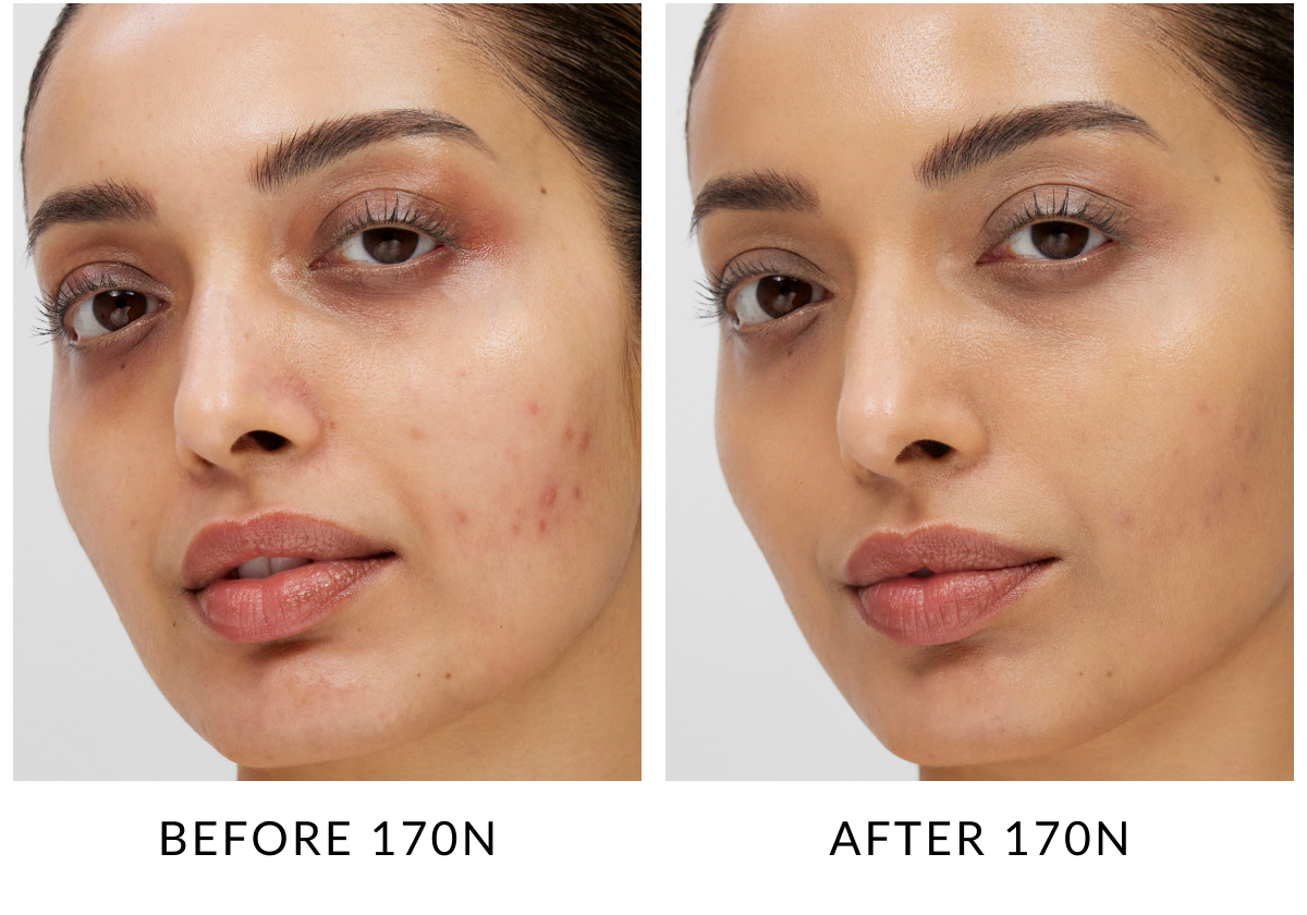 Skin Base before & after
