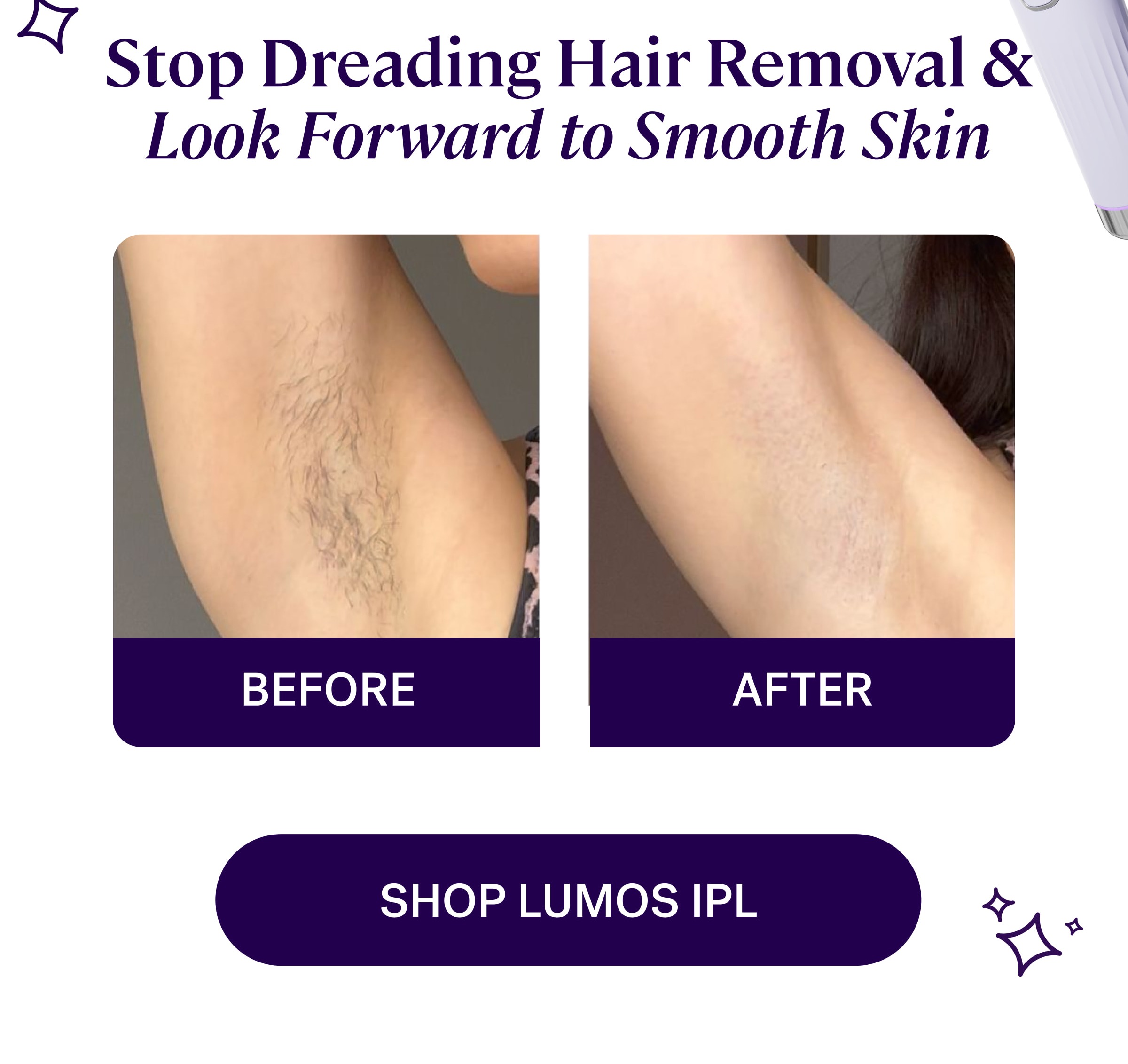 Stop Dreading Hair Removal & Look Forward to Smooth Skin shop lumos ipl