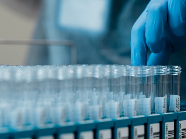 Lab technician pulls test tubes of specimens.