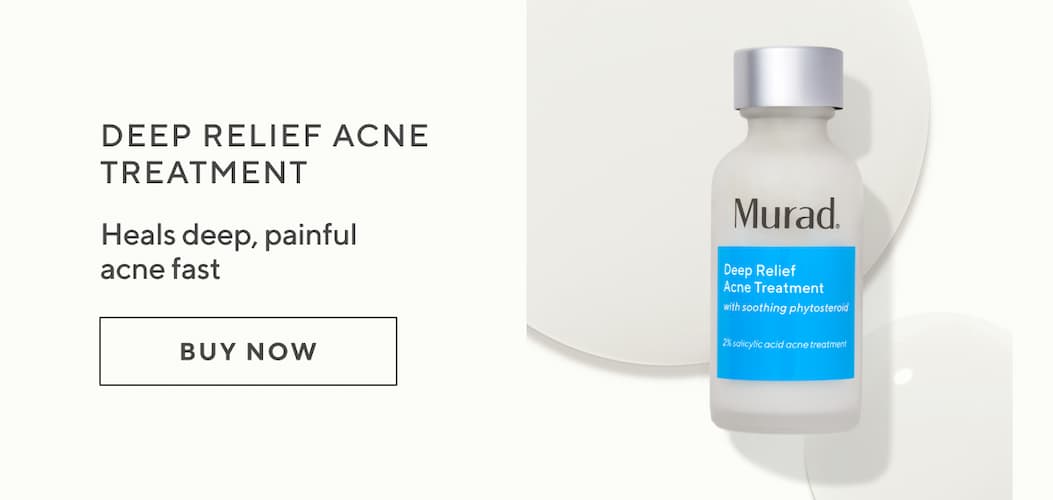 Deep Relief Acne Treatment