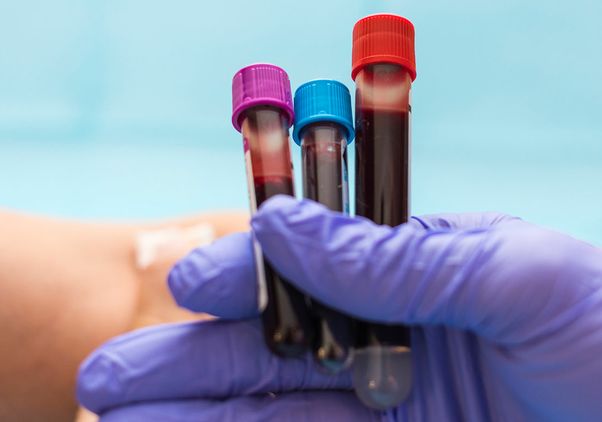 Purple-gloved hand holding three vials of blood samples