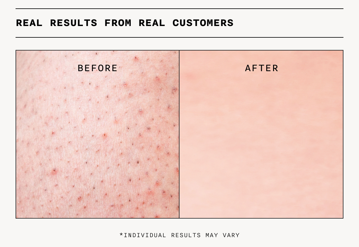 Real Results From Real Customers - Before & After Using The Eraser