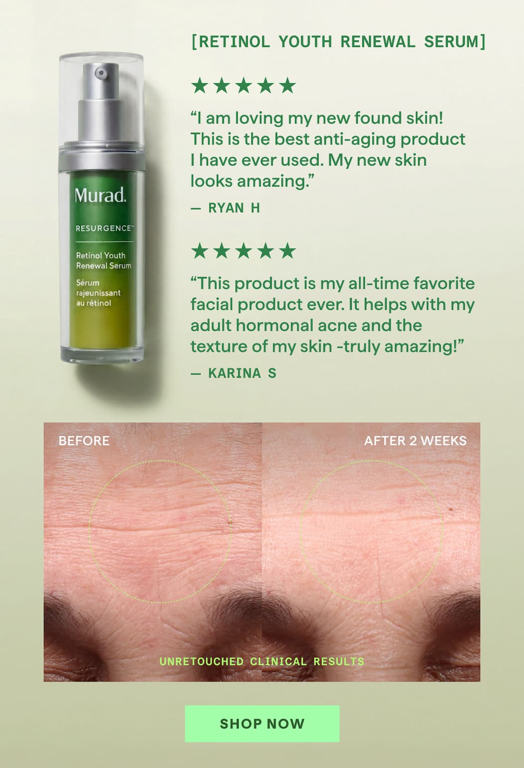 Retinol Youth Renewal Serum Shop Now