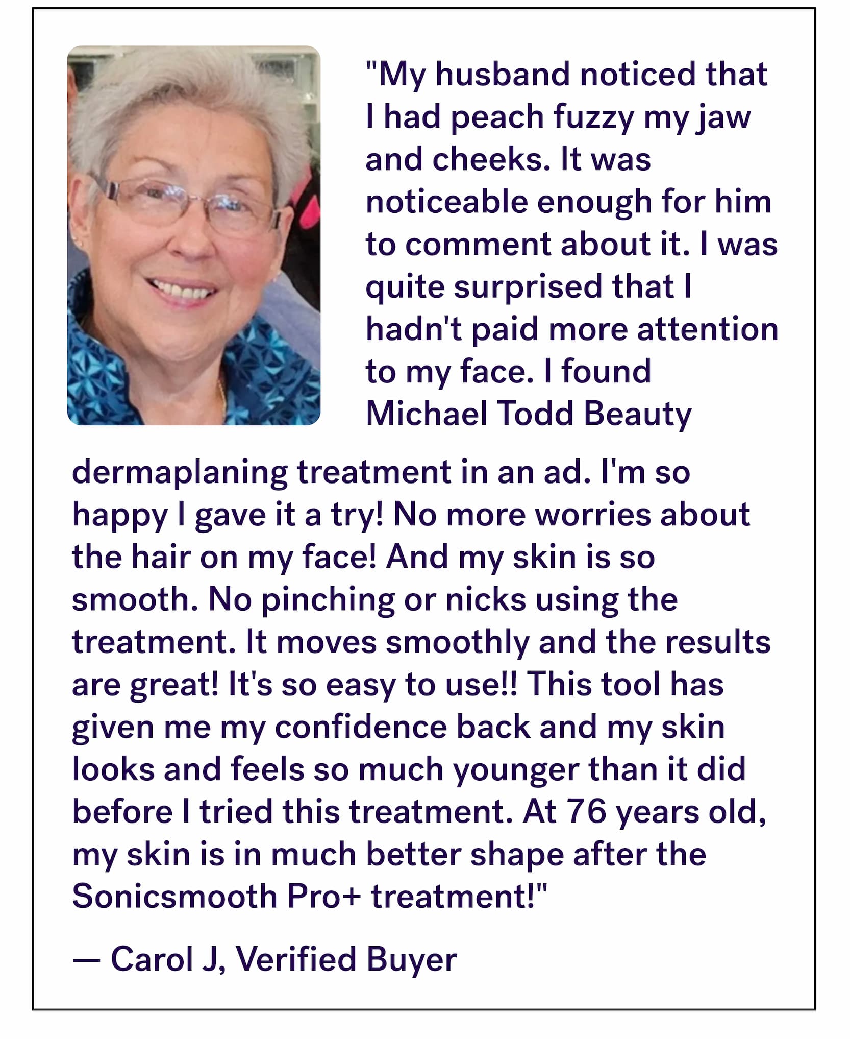 "My husband noticed that I had peach fuzzy my jaw and cheeks. It was noticeable enough for him to comment about it. I was quite surprised that I hadn't paid more attention to my face. I found Michael Todd Beauty  dermaplaning treatment in an ad. I'm so happy I gave it a try! No more worries about the hair on my face! And my skin is so smooth. No pinching or nicks using the treatment. It moves smoothly and the results are great! It's so easy to use!! This tool has given me my confidence back and my skin looks and feels so much younger than it did before I tried this treatment. At 76 years old, my skin is in much better shape after the Sonicsmooth Pro+ treatment!" —&nbsp;Carol J, Verified Buyer