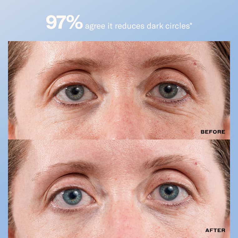 5% Volufiline