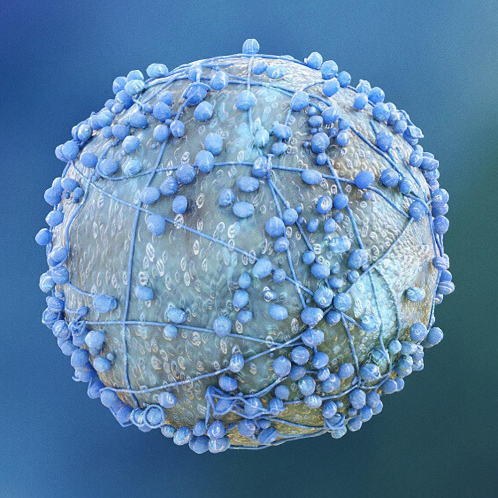 A pancreatic cancer cell