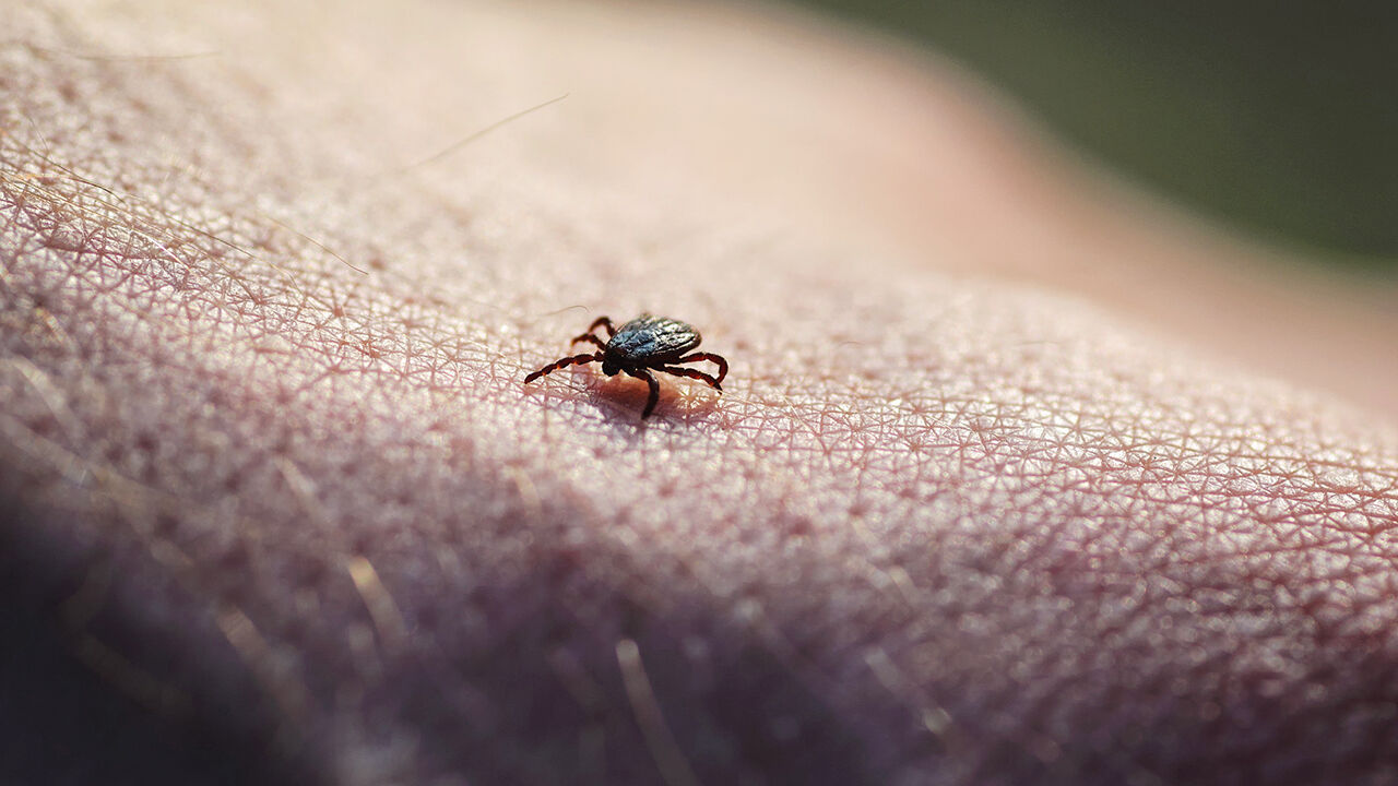 Tick insect parasite crawling on human skin