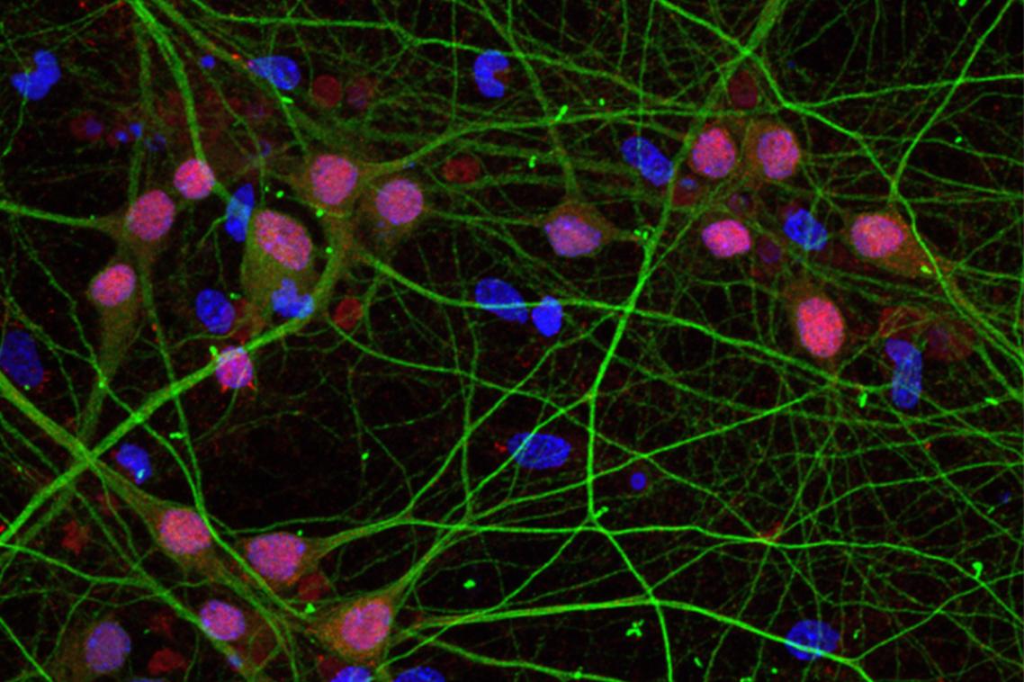 Microscope image of cells coloured blue or pink with green neuronal dendrites or branches.