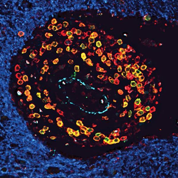 Image of a T-cell