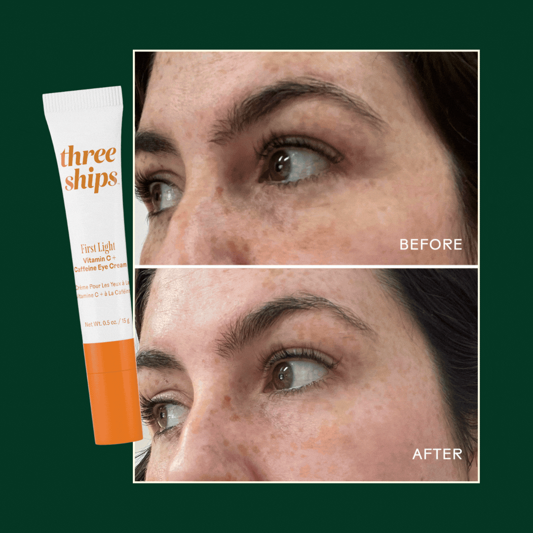 Customer before & after images
