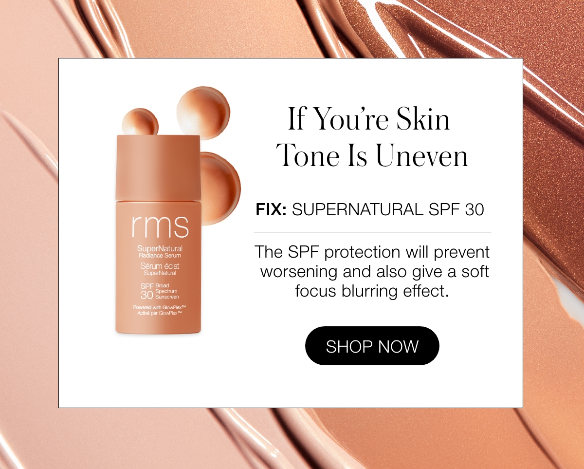 Uneven Skin Tone: Use Supernatural SPF 30
