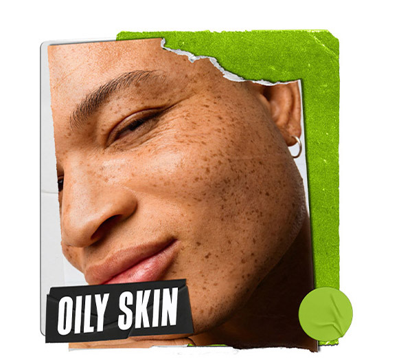Oily Skin