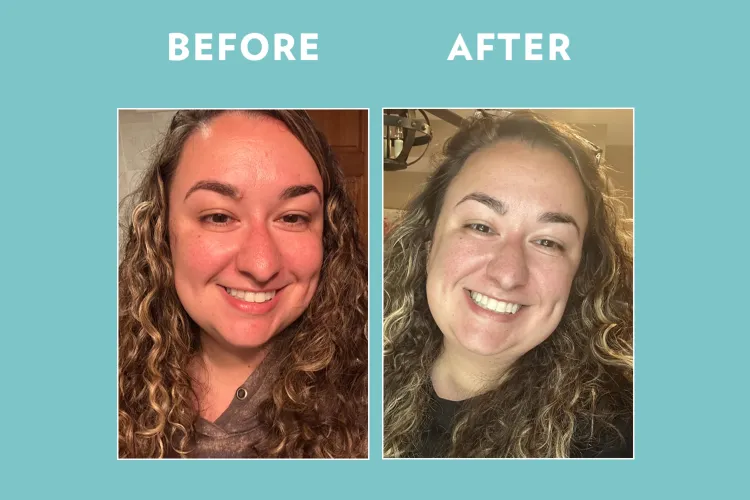 I Swear This Wrinkle-Smoothing Serum Is Like Botox in a Bottle — It Softened My Forehead Lines in Just 2 Weeks