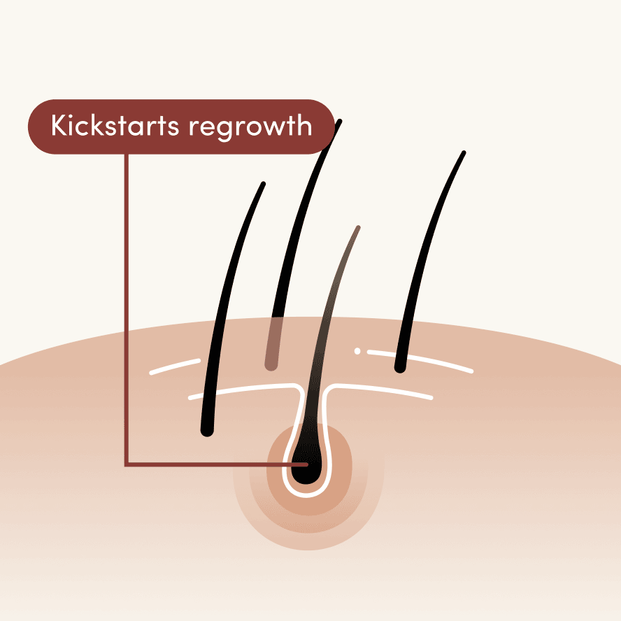 Kickstarts regrowth