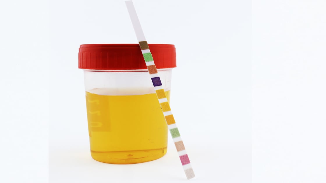 ph-pee-test-3