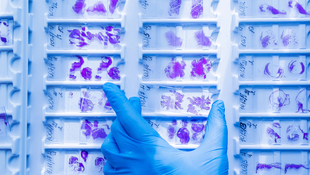 AI platform flips the script on how tumors are analyzed