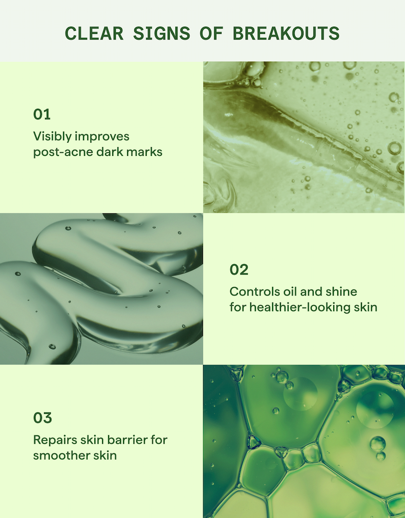 Clear signs of breakouts