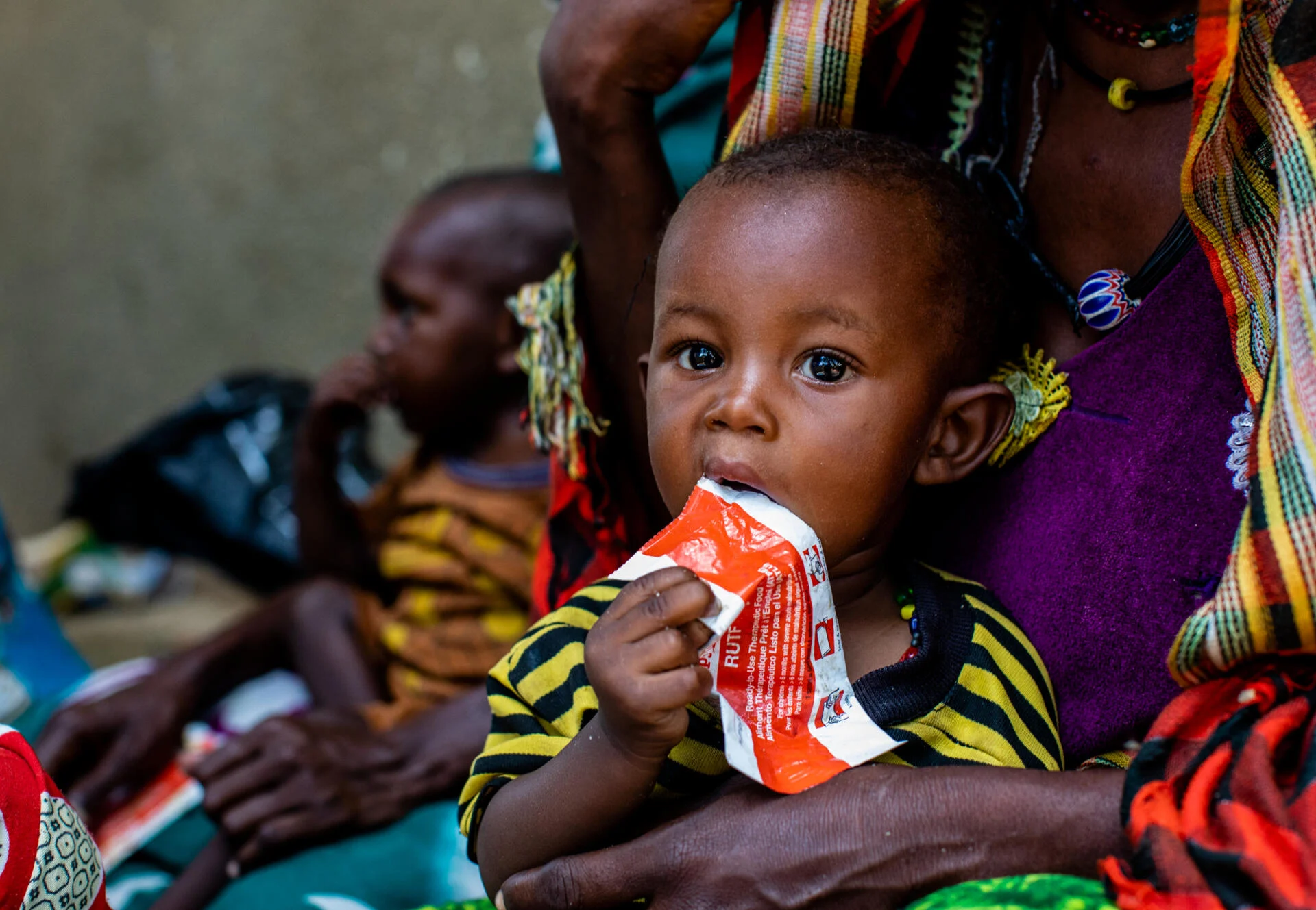 A young child experiencing acute malnutrition receives treatment at an IRC health center in Mangalme, Chad.